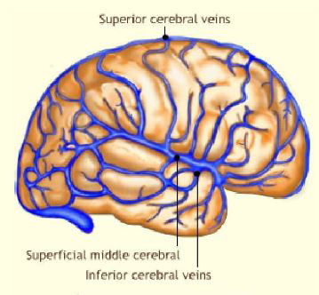 Cerebral Ventricles and Vessels