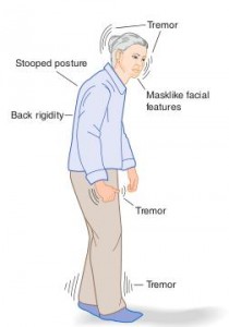 Abnormalities of Movement