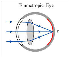 Emmetropic Eye
